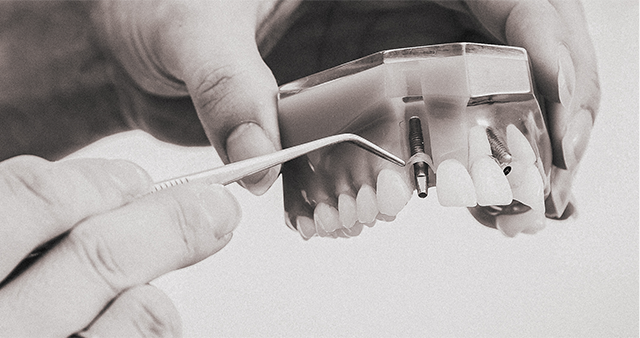 maintenance parodontale