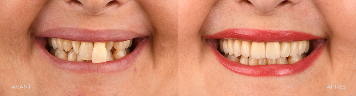 CAS 1 ESTHETIQUE