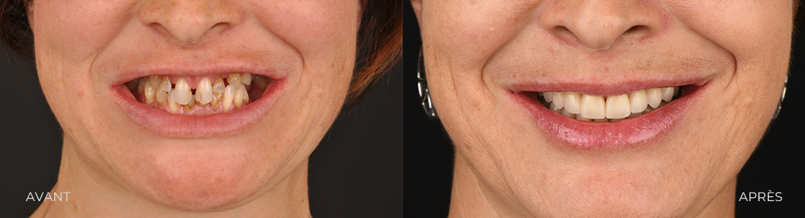CAS 2 ESTHETIQUE