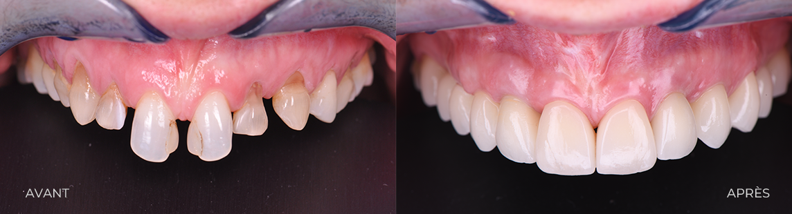 CAS 2B ESTHETIQUE