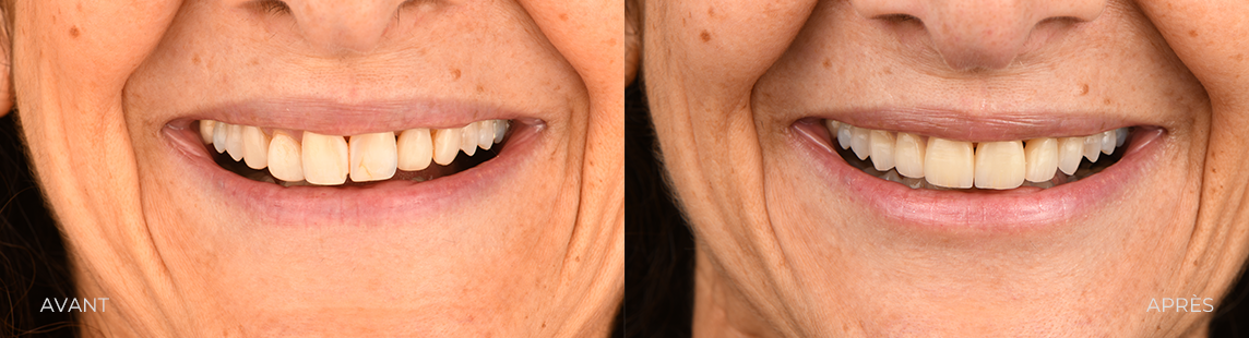 CAS 3 ESTHETIQUE