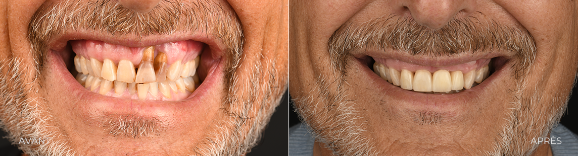 CAS 4 ESTHETIQUE